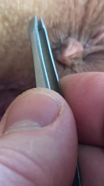 This is what happens when you ask your husband to help you remove the hair around the asshole and in the bikini area...