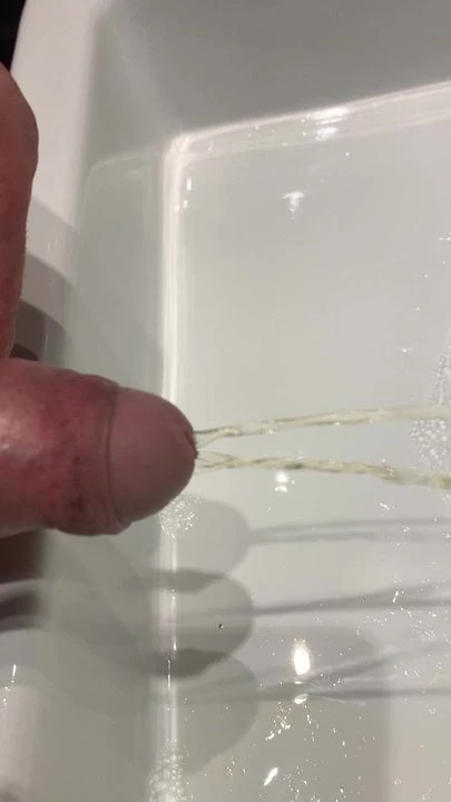 Pee