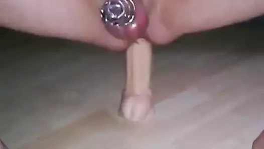anal1