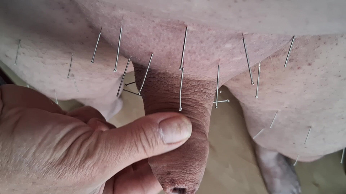 Needles