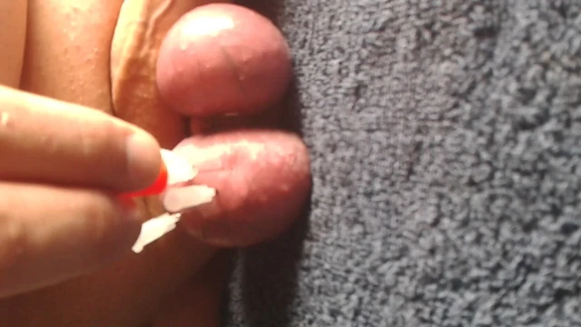 Needle