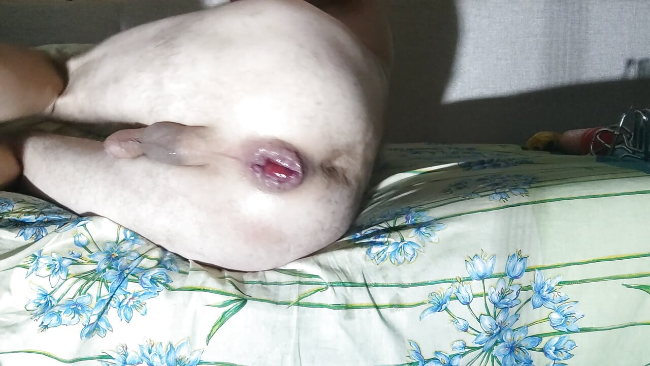 Masturbação anal