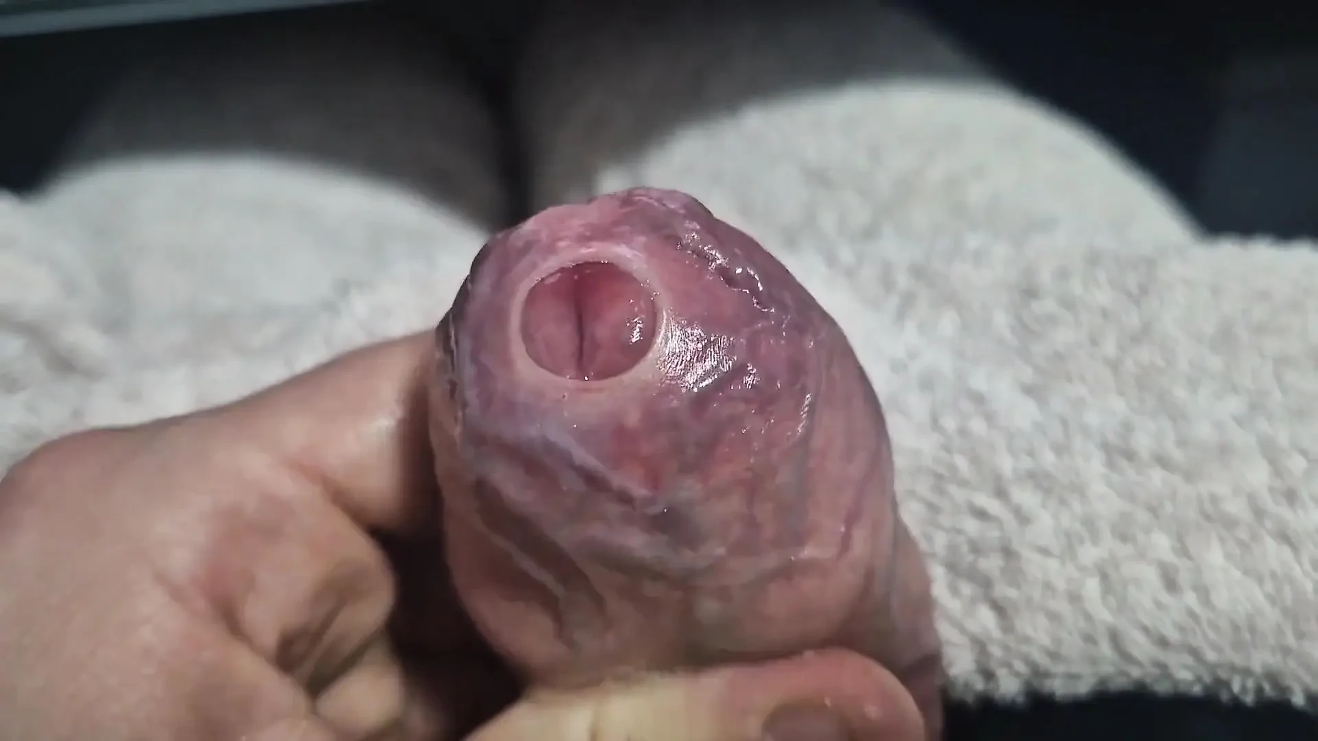 언컷 꽉 조이는 Phimosis 자지 포피 클로즈업