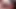 Sunset Anal with bald girl. Deepthroat and cumshot on the bald head