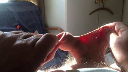 Six items of foreskin stretch in sunlight