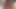 エボニーの継姉妹が私のペニスを使ってアナル - レイン・カーター - アナルセラピー - アレックス・アダムス
