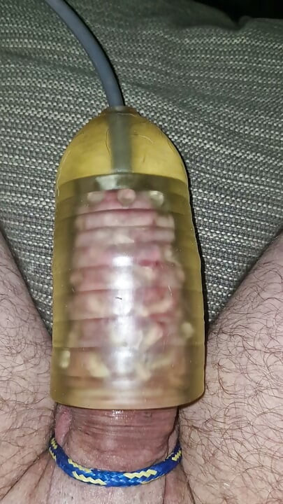 吸吮机器