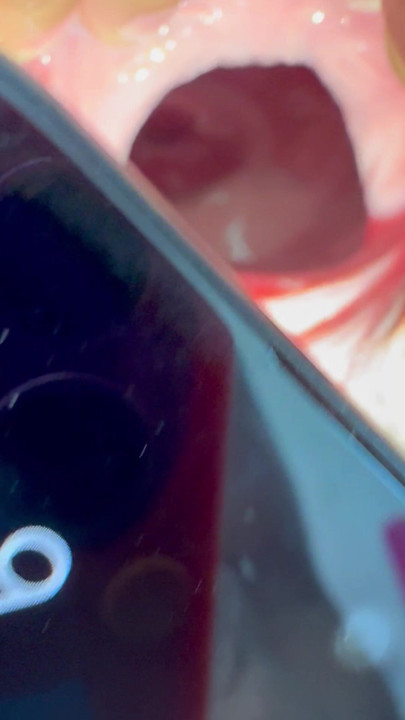 Gaură de pizdă lărgită