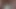 LizzyYum VR February 2024 I.C.E. ANAL Post Op Orgasm Pussy anal masturbation teasing