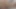 Lizzy Yum July 2023 Just Monday Post-op Orgasm Pussy Clit Masturbation Teasing Orgasm