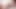 Prescription for Passion -Skin-on-Skin Pulse-to-Pulse- Overwatch Mercy Beauty Queen Romantic Sex