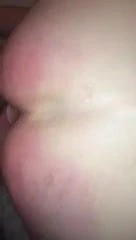 My asshole in pain