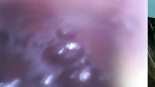 Endoskopi!! Giantess Menelan 25 Anggota Sekali lagi