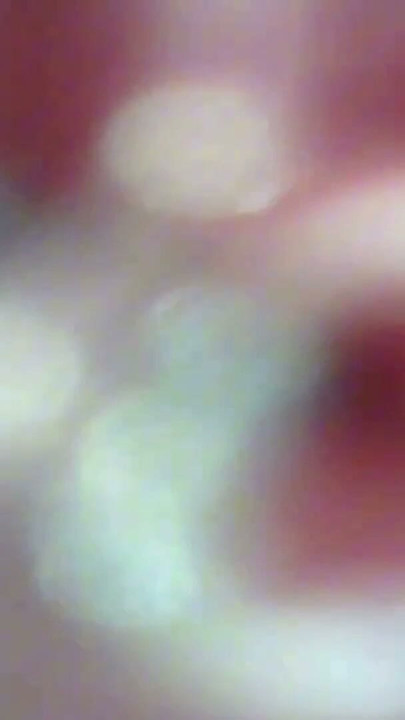 The camera in the penis shows the best picture of the male orgasm event | Clip 1