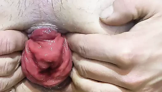 Pump porn video – Anal prolapse pump