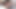 子宮頸部検査と成熟したエリスの尿