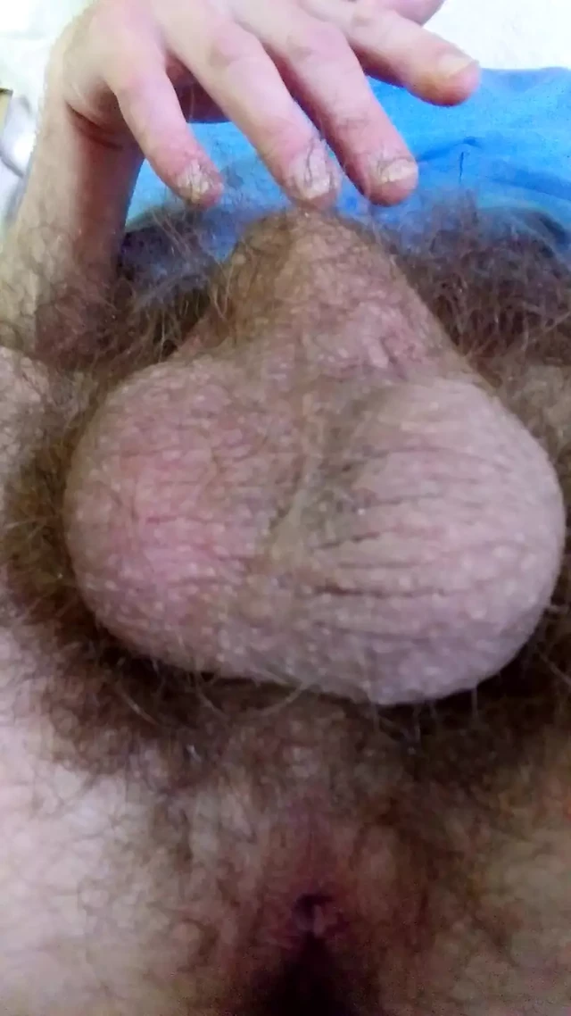 My Ball Sack Moves All By Itself