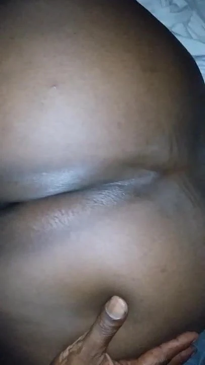 Cheeks