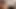 TEASER