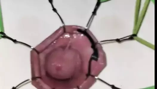 Fishhooks through foreskin