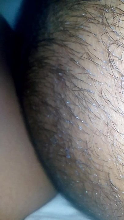 Closeup