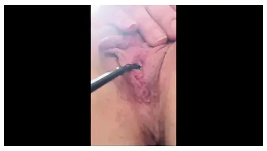 Dilator in My Pisshole