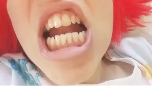 Зубы Chantal разваливаются, Rotten и Black