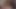 何度もむち打ち