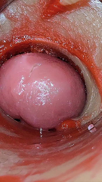 Kamera Unutar Duboke Pičke Snima Predoziranje Ejakulacija Sperme Asmr
