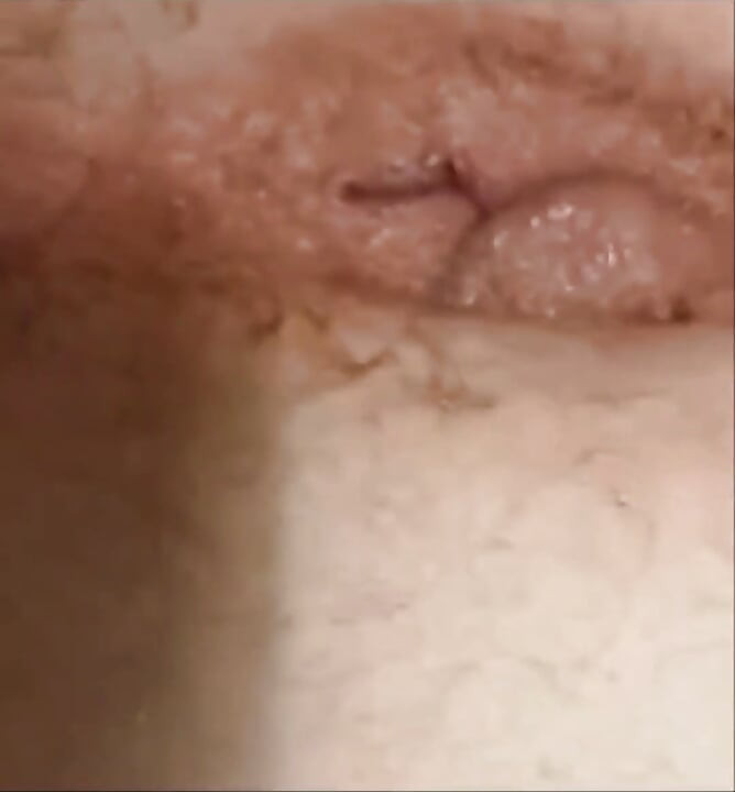 Anal play and gapimg