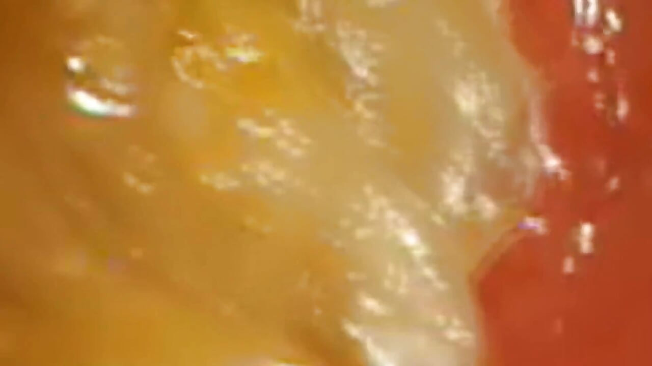Inside Me the Journey of the Orange