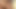 Masturbating Phimosis Cock