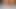 Nudist 12 mm Prinzenzepter im  Pissloch und anal Prolapse