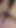 My ass again