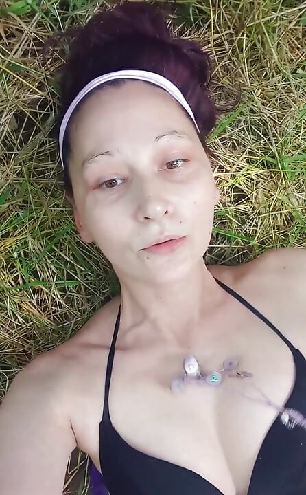 Something Bit My Ass and Tits