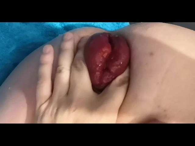 my prolapse