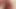 Sounding with a 10 mm wide 350 mm long silicone sound