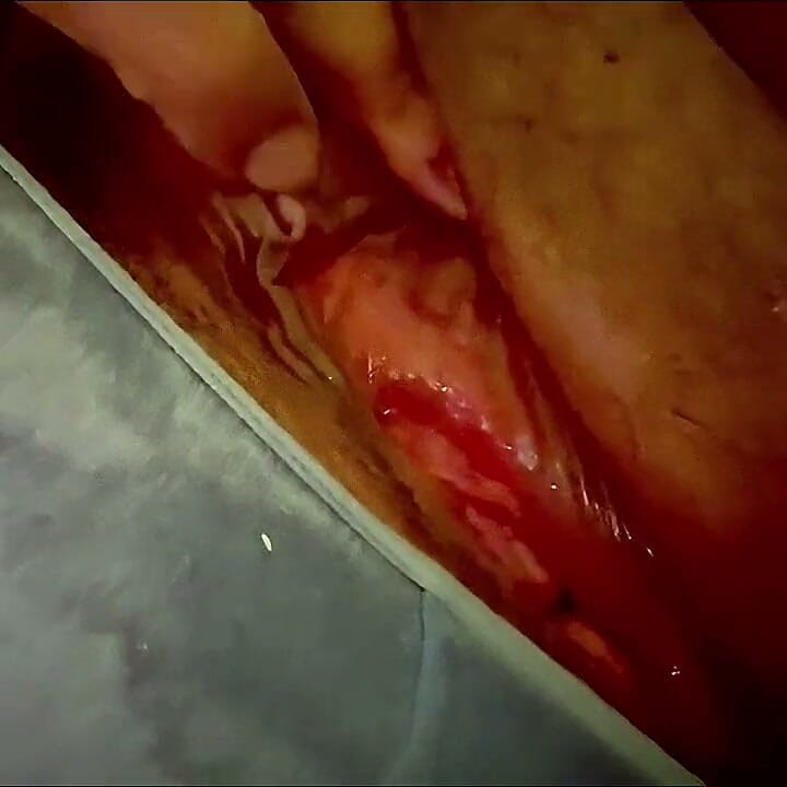 Teasing Spreading My Pussy Rubbing My Clit