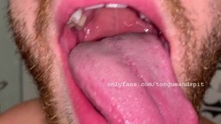 Brogan Mouth Video 1