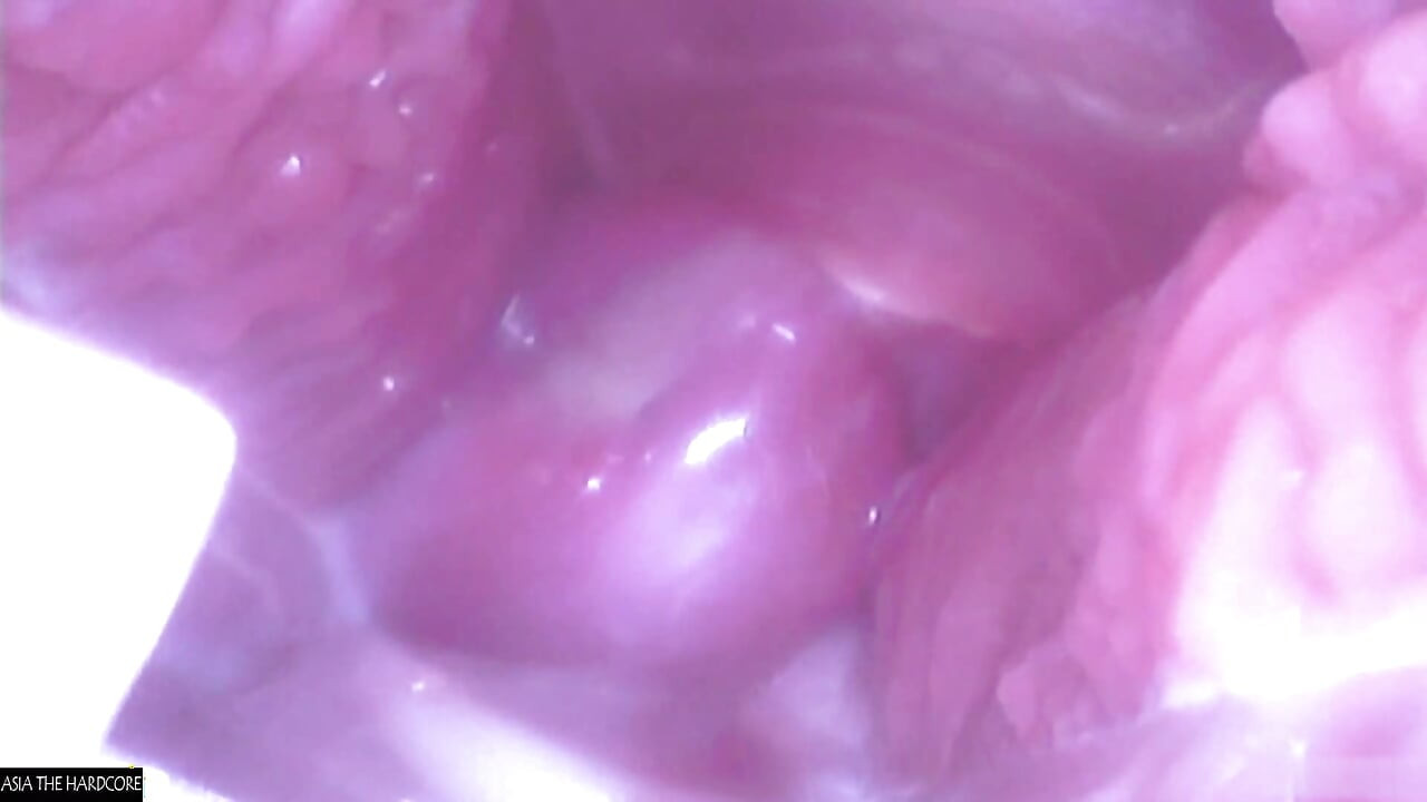 Азиатски ангел 28004