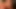 Der Nachbar kam für eine Gesichtsbesamung