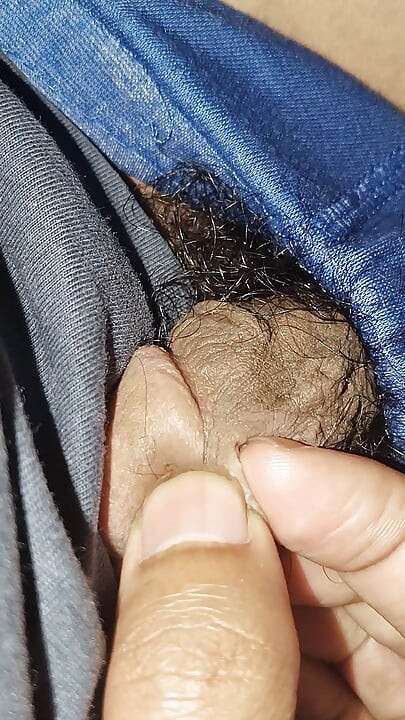 Acne on my penis I want to clean it up