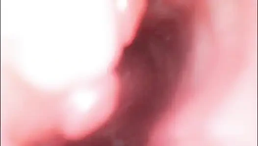 Endoskopische creampie. Cam Inside, muschi zeigt, wie schwanz in der muschi kommt