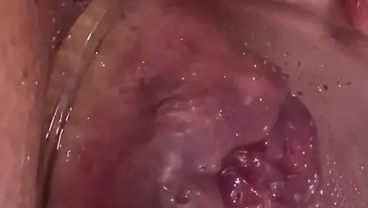 Aşırı anal vakum pompası eğitimi 2025