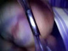 Video pregled