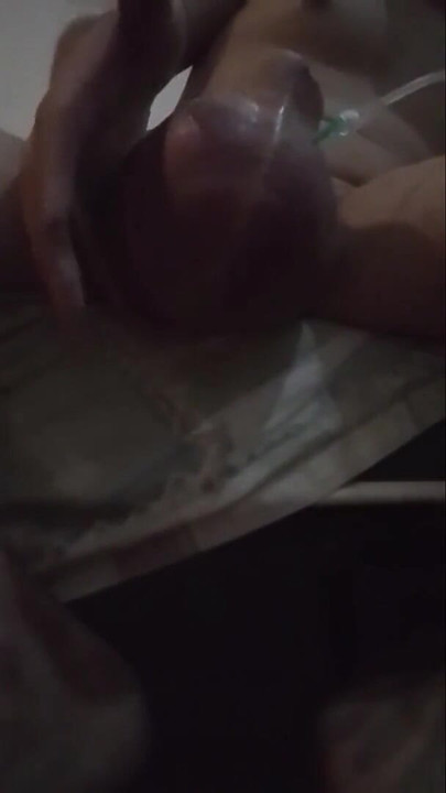 Stunning moment from "My journey of having 2L of D5NS turn my sac into a hot air balloon  (part1)"