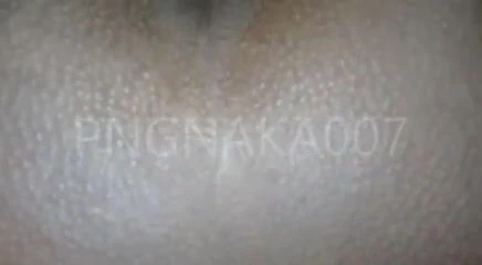 PNG FUCKING OUTTA THATS ASSHOLE