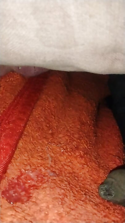 น้ําแตกแสนหวานของกู