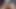 Meri pussy chd chud ke sooj gayi