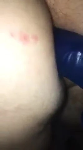 Peging
